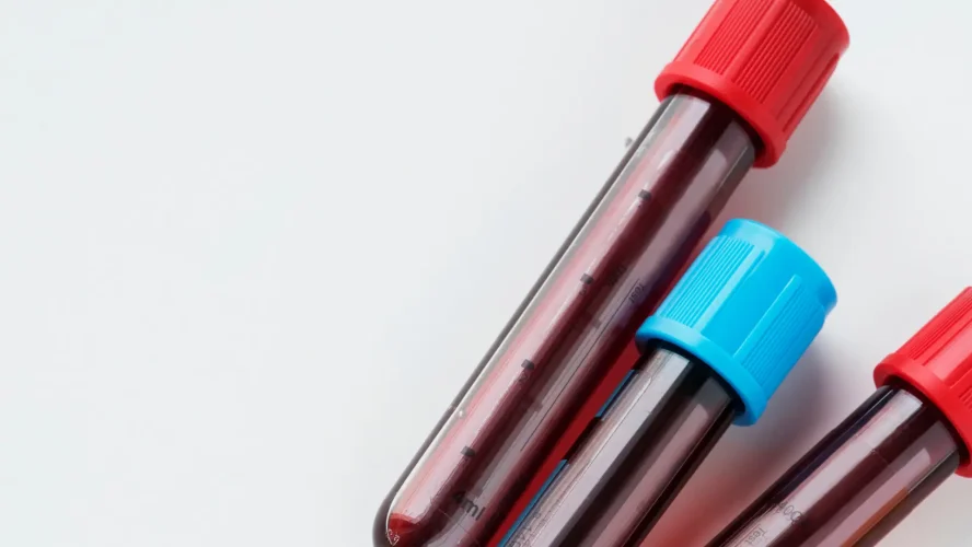 Basic Health Screening Kuala Lumpur | Early Disease Detection