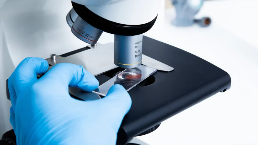 Non-Invasive Cancer Detection Malaysia | Circulating Tumor Cell Test